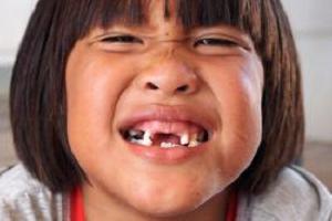 сколько болит зуб после удаления