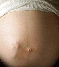 шевеление ребенка во время беременности