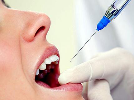 местная анестезия в стоматологии