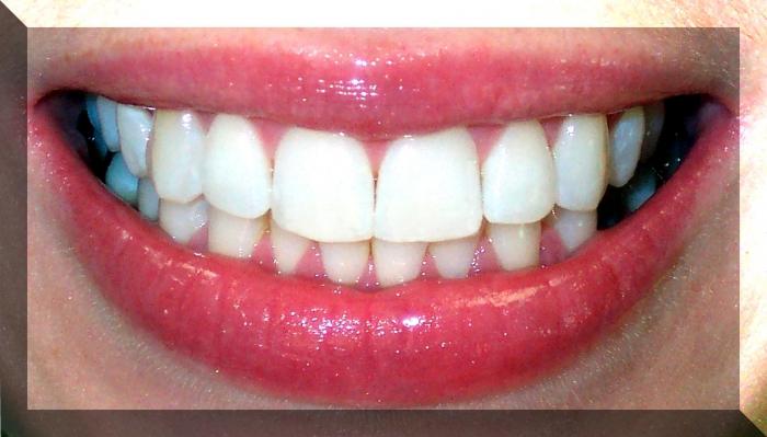 нумерация зубов в стоматологии 