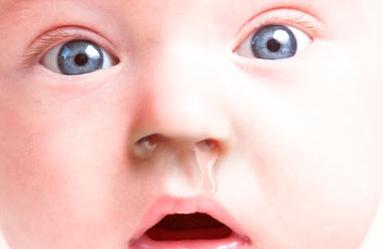 заложен нос у новорожденного