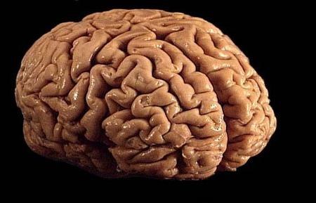 головной мозг