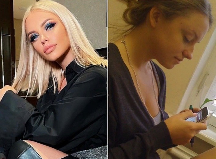 Тюльпанова милана до пластики и после