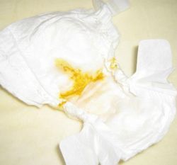 Стул у новорожденных: норма и отклонения