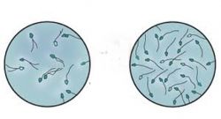 Как сдавать спермограмму и почему этого не стоит бояться