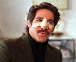 Приснился деформированный или сломанный нос? Читайте, что это значит