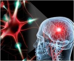 Рассеянный склероз. Продолжительность жизни. Симптомы. Лечение