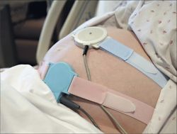 О чем может рассказать КТГ плода