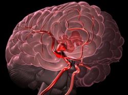 Отчего возникает кровоизлияние в мозг и чем оно опасно