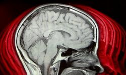 Энцефалопатия головного мозга: симптомы, диагностика и лечение