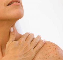 Лечим пигментные пятна на теле вместе