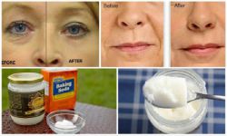 Маска для лица из соды: польза, противопоказания и рецепты