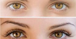 Что такое ботокс ресниц? Фото до и после, особенности процедуры
