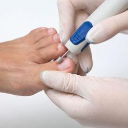 Аппаратный педикюр: что это такое, описание процедуры, преимущества и недостатки