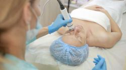 РФ-лифтинг лица: отзывы врачей косметологов, описание процедуры, противопоказания. RF-лифтинг