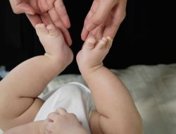 Дисплазия тазобедренных суставов у детей: признаки, причины и лечение