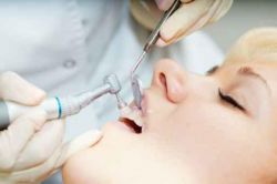 Методы чистки зубов в стоматологии