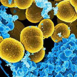 Почему в уголках губ болячки появляются, чем их лечить?