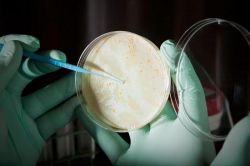 Анализ на чувствительность к антибиотикам: как сдавать, расшифровка результатов