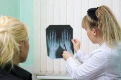 Что показывает анализ крови АЦЦП? Расшифровка