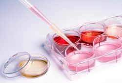 Индекс распределения эритроцитов понижен: что это значит и что делать? Снижение RDW: патология и норма