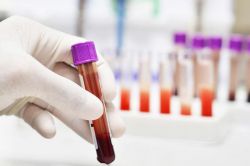 Анализ ФСГ - что это такое у женщин?