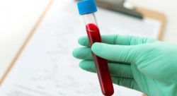 PLT в анализе крови - что это такое?