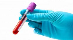 Как сдать анализ на прогестерон правильно?