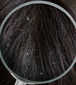 Дегтярный шампунь 