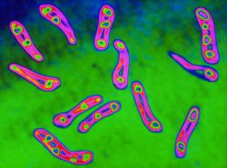 Дифтерия: что это за болезнь, первые признаки, диагностика, лечение и профилактика