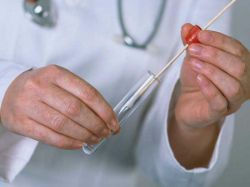 Типы герпеса, симптомы и лечение