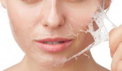 ТСА-пилинг: что это такое, отзывы, последствия и противопоказания 