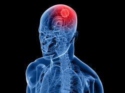 Что такое опухоль? Стадии, причины, симптомы, лечение