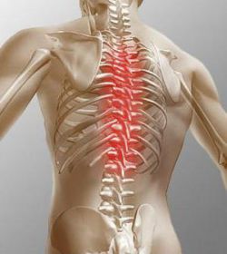 Что такое дорсопатия, и как ее лечить?