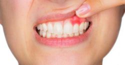 Болят десны - что делать в домашних условиях? Причины и лечение воспаления десен