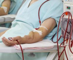 Что такое фистула: описание, преимущества и признаки