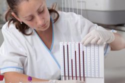 Что такое СОЭ? Нормы и патологии