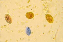 Что такое циста - особенности, стадии развития и способы лечения