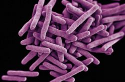 Что такое Манту? Проба Манту: норма у детей