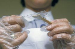 Лептотрикс в мазке: что это такое, причины, симптомы и лечение