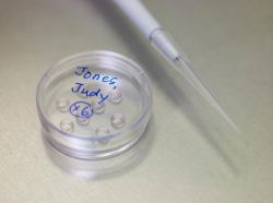 ЭКО с донорской яйцеклеткой: отзывы, шансы, квота