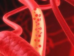 Как на организм влияет алкоголь? Расширяет или сужает сосуды?