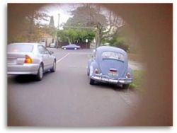 Глаукома: симптоми опасного заболевания