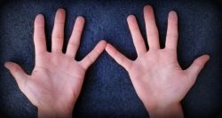 Волдыри на руках: возможные причины их появления
