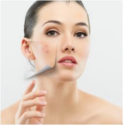 Что делать, если появились прыщи на щеках?