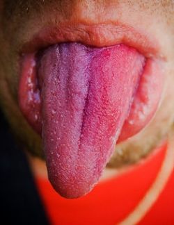 Если у вас кисло во рту, возможно, вы чем-то больны