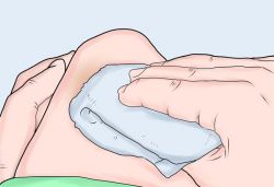 Чем вытянуть гной: мази и рекомендации