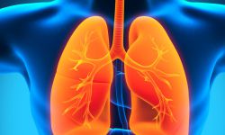 Аспирационная пневмония: причины, симптомы, лечение и профилактика