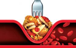 Дислипидемия - что это за болезнь? Классификация, типы, степени, диагностика и лечение