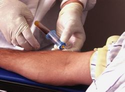 О чем говорит норма СА-125 и ее превышение